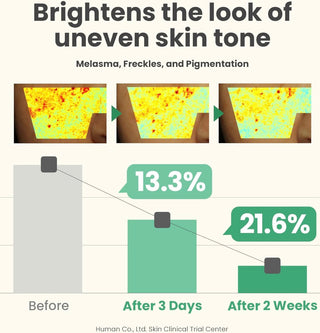 AXIS-Y The Mini Glow Set