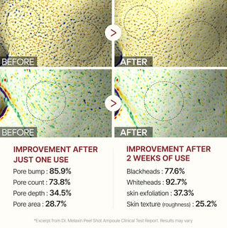 Dr. Melaxin Peel Shot Exfoliating Black Rice Ampoule 80ml