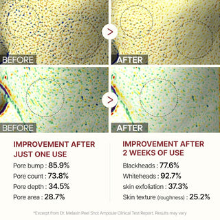 Dr. Melaxin Peel Shot Exfoliating White Rice Ampoule 80ml