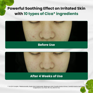 Dr.G R.E.D. Blemish Clear Soothing Cream 