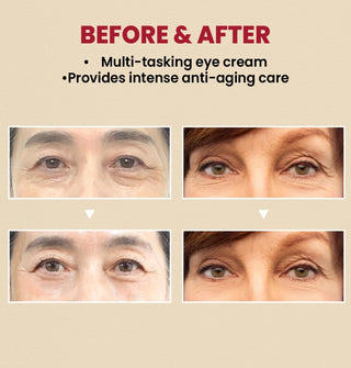 KSECRET SEOUL 1988 Eye Cream: Retinal Liposome 4% + Fermented Bean - Sk1ntro