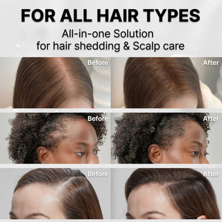 Lilyeve GROW:TURN Ampoule 100ml