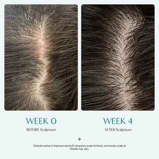 Lilyeve SCALP:TURN CICA PDRN Brush Ampoule 100ml