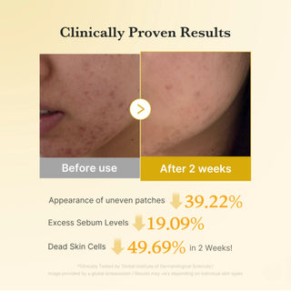 Medicube Kojic Acid Turmeric Pad 70pads