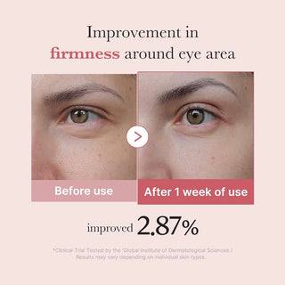 medicube PDRN Pink Peptide Eye Cream 30ml