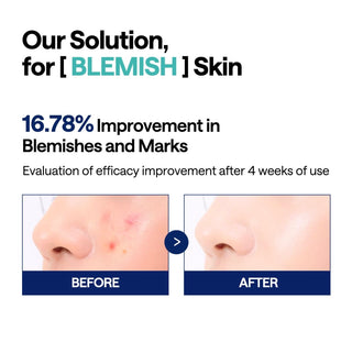MEDIHEAL Madecassoside Blemish Pad 100pads