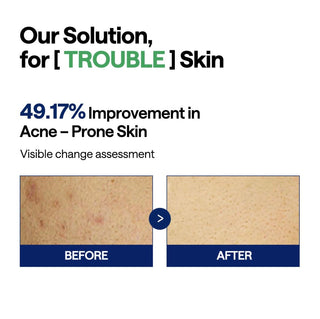 MEDIHEAL Teatree Trouble Pad 100 pads
