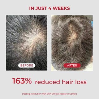 Moev Annurcatin Shampoo 525ml