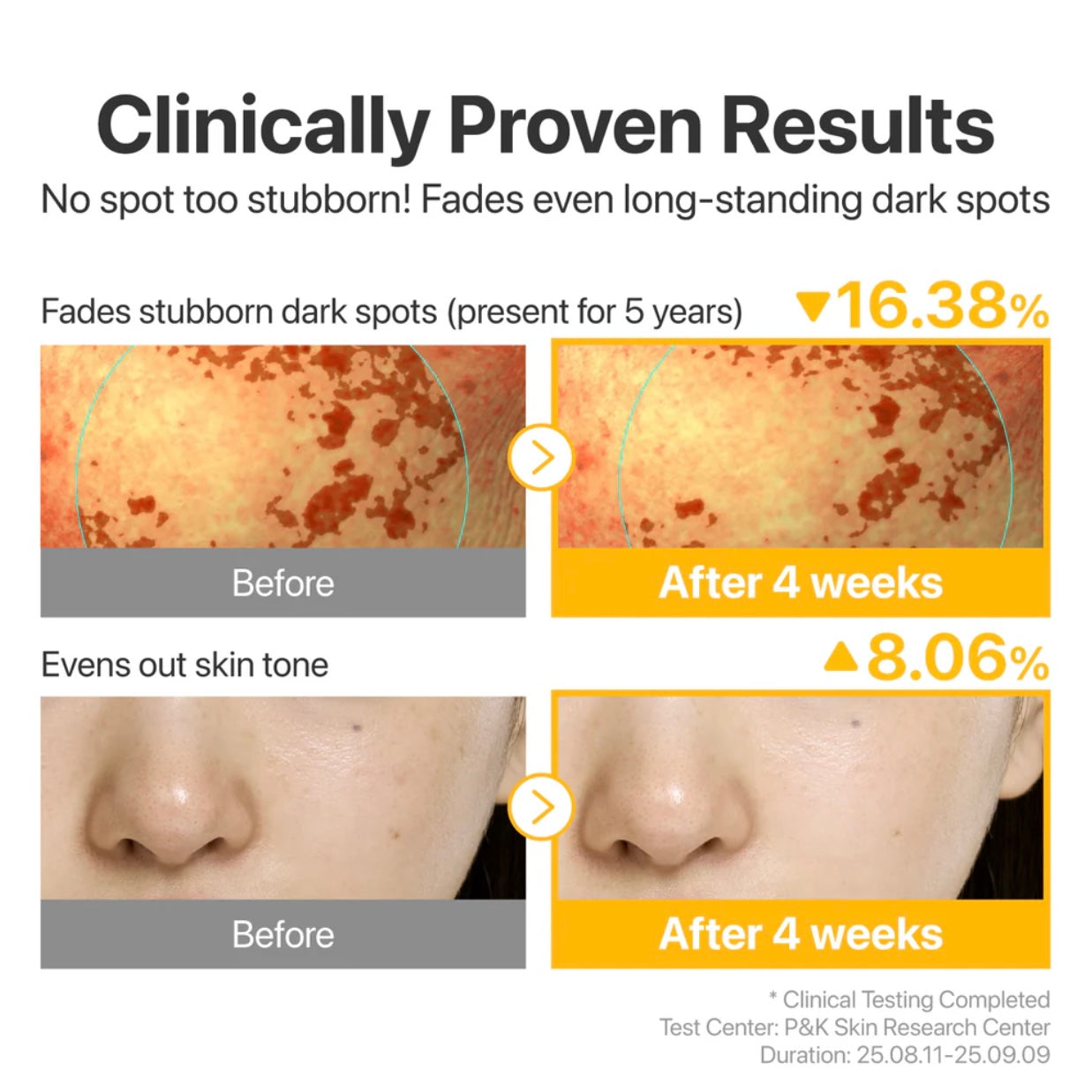glutathione hyperpigmentation Korean Glutathione for my Hyperpigmentation main image 0