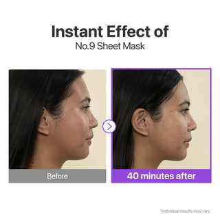 numbuzin No.9 NAD+ BIO Lifting-sil Full Face Mask (4 Sheet + Lifting Band)