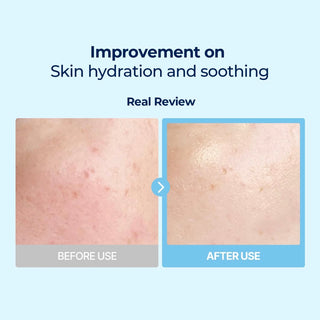 Torriden DIVE-IN Low Molecular Hyaluronic Acid Multi Pad 80pads