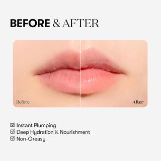 VT Reedle Shot Lip Plumper Beginner - Sk1ntro